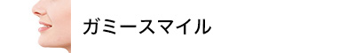 ガミースマイル